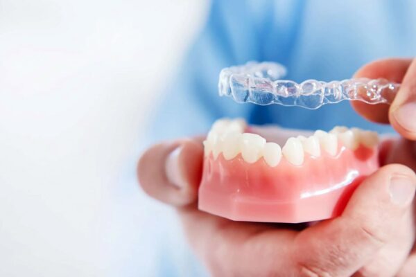 町田の矯正歯科が教える、矯正にかかる期間が長いのはなぜ？
