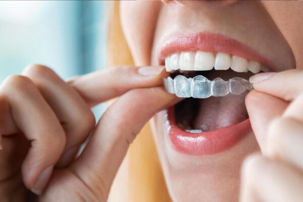 町田の矯正歯科がインビザラインをおすすめする理由とは？